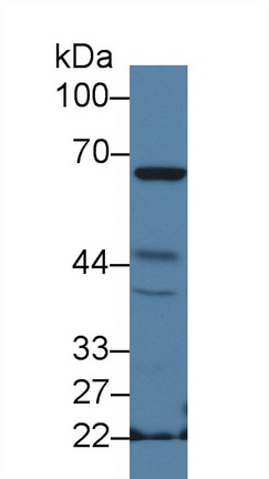 9385