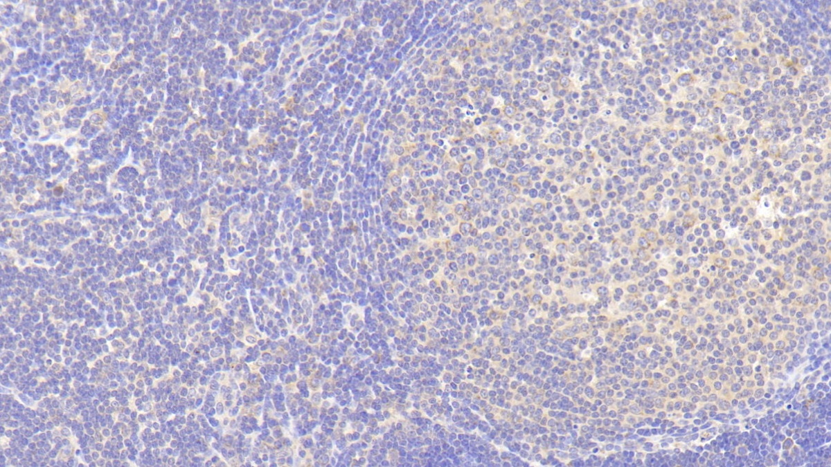 21170