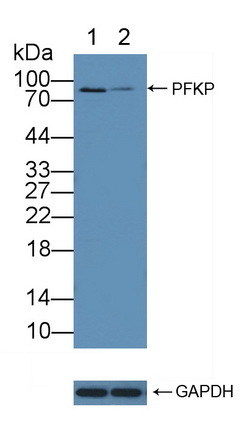 12147