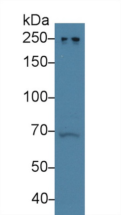 9533