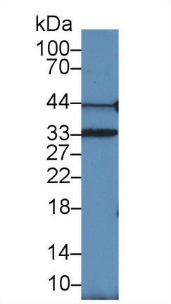 17696