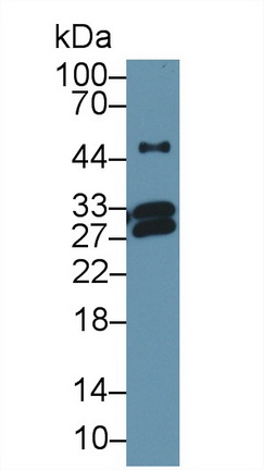 14642