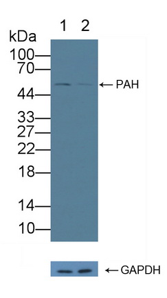 12236