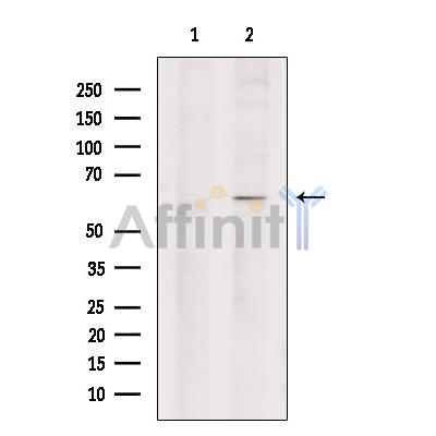 Валидация Affinity DF7076 - 18716