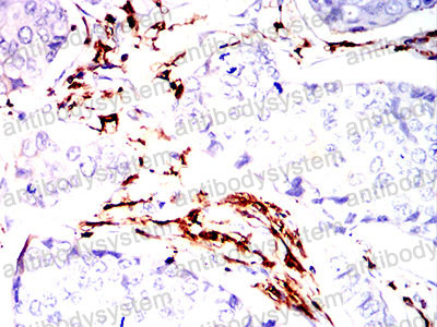 Валидация AntibodySystem RHM01701 (3766)