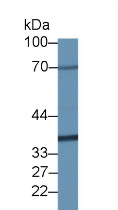 14414