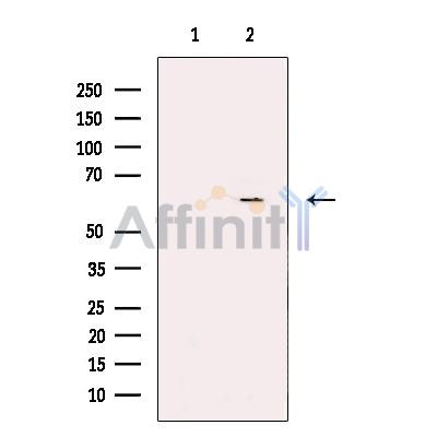Валидация Affinity DF3570 - 14522