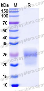 EHC08102, SDS-PAGE