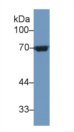 13261