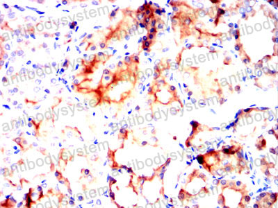 Валидация AntibodySystem RHN06803 (3796)