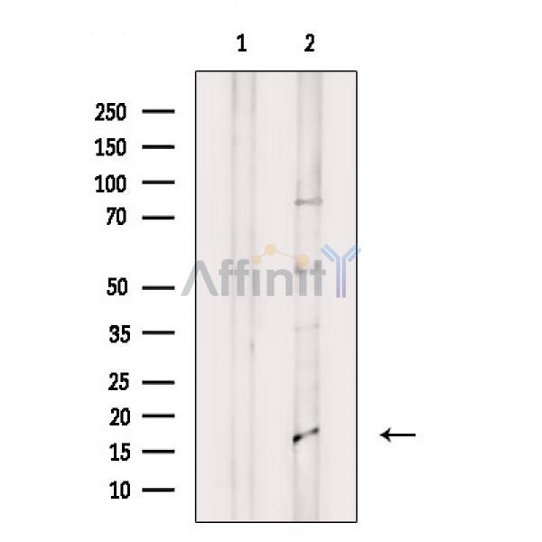 Валидация Affinity DF2525 - 13181