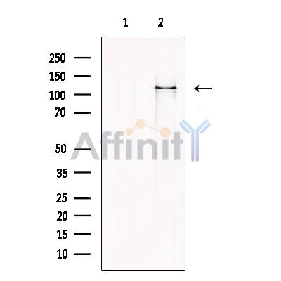 Валидация Affinity DF13651 - 9207