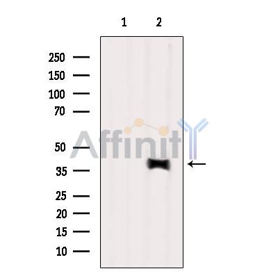Валидация Affinity AF6087 - 3290