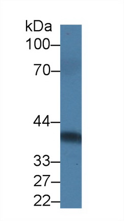 14341