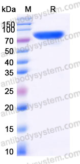 EHJ63003, SDS-PAGE