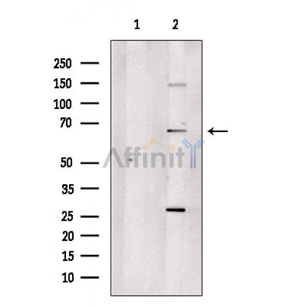 Валидация Affinity DF3821 - 14945