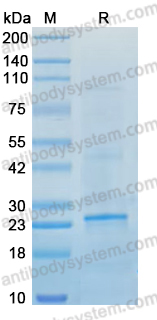 YXX54202, SDS-PAGE