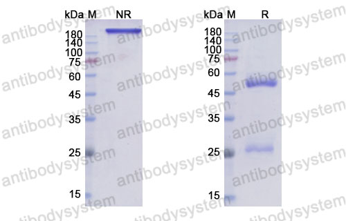 Валидация SDS-PAGE - AntibodySystem DHJ92103