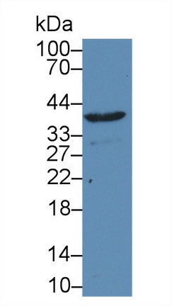 14645