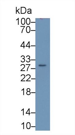 17607