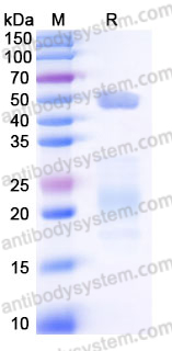 EHJ04201, SDS-PAGE