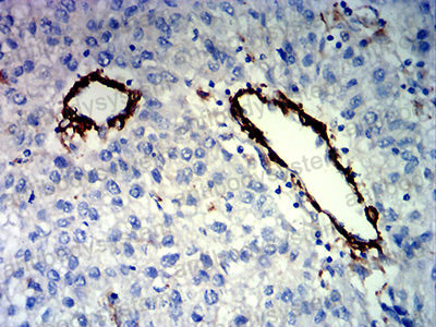 Валидация AntibodySystem RHF87802 (2715)