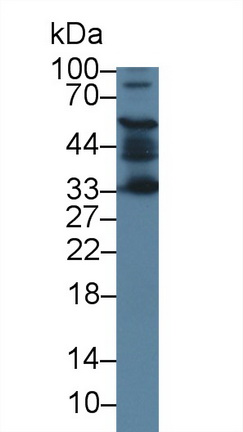 12609
