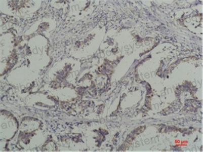 Валидация AntibodySystem RGK60105