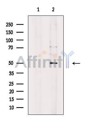Валидация Affinity AF6624 - 3915