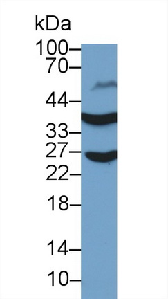 13656