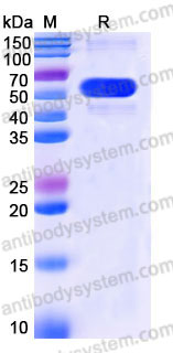 EHB88301, SDS-PAGE