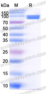 EHD33102, SDS-PAGE