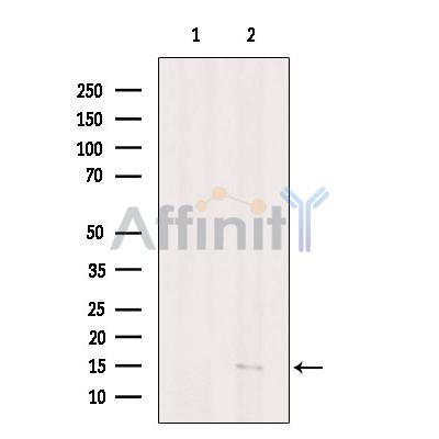 Валидация Affinity DF6695 - 18198