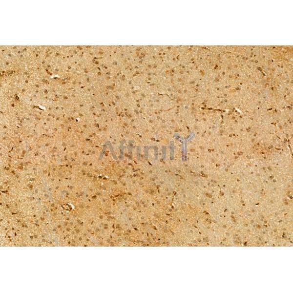 Валидация Affinity DF12076 - 6155