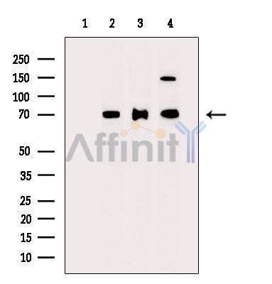 Валидация Affinity DF14408 - 10340