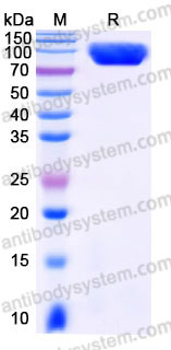 AHC25201, SDS-PAGE