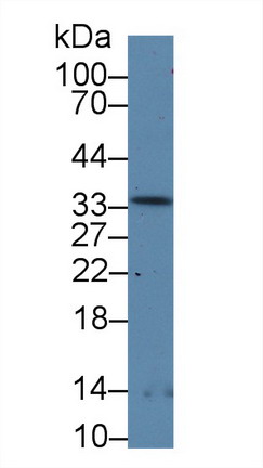 9118