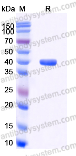 YHD67402, SDS-PAGE