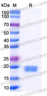 EHD26901, SDS-PAGE