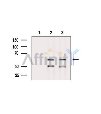 Валидация Affinity DF15598 - 12020