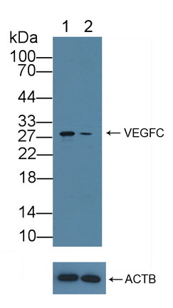 12087