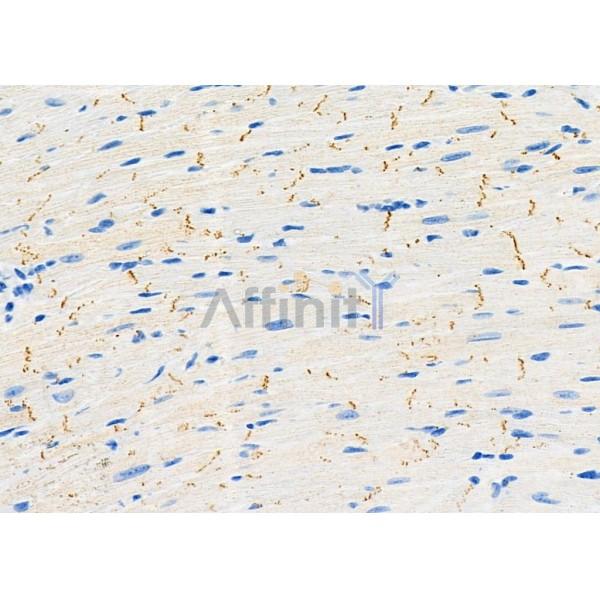 Валидация Affinity DF9554 - 22217