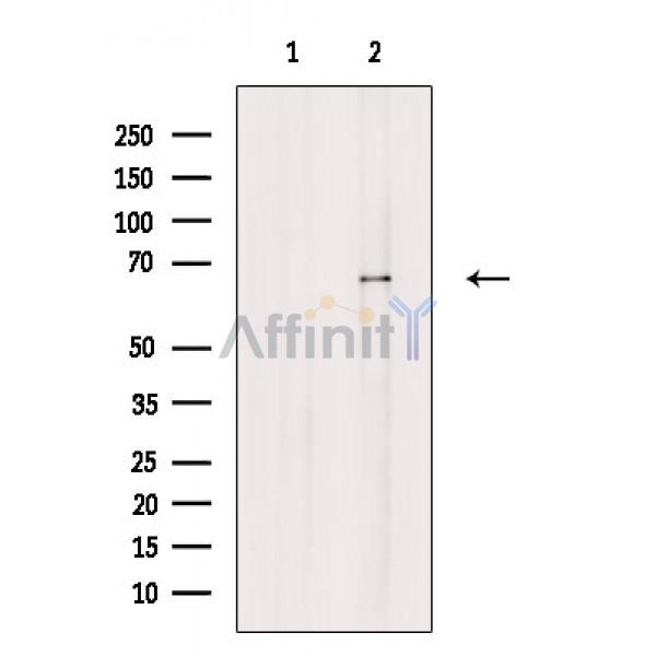 Валидация Affinity DF2460 - 13088