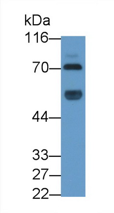 36179