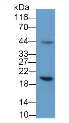 27560