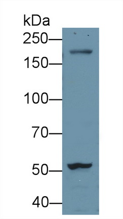 14951