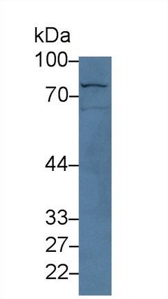 13990
