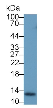 65223
