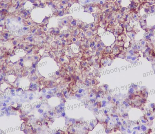Валидация AntibodySystem RHF08702