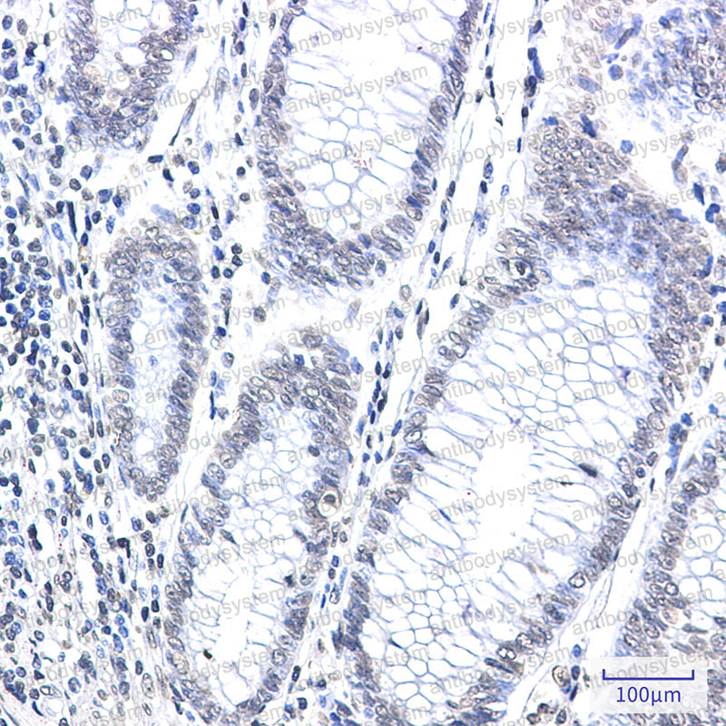 Валидация AntibodySystem RHD94901